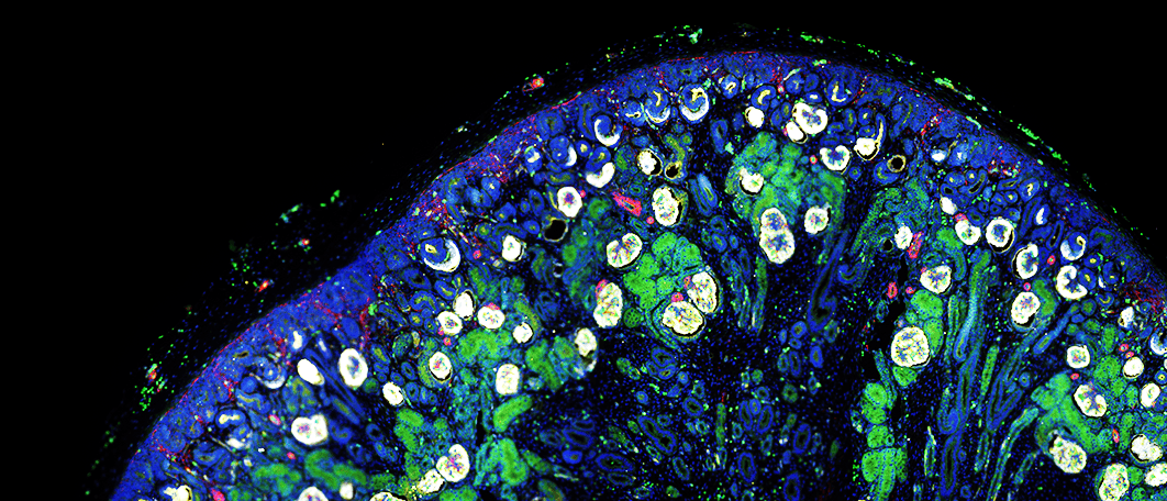 Single-cell transcriptomics reveals gene expression dynamics of human fetal kidney development